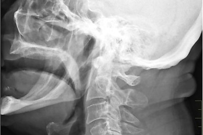 Now, a device to help stutterers speak fluently