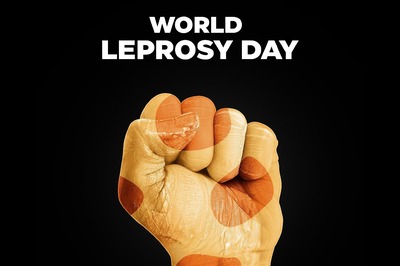 Urgently Address Gaps in Leprosy Services Disrupted by Covid-19 Pandemic: WHO