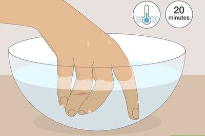 How to Deal With the Pain of a Door Being Shut on Your Finger