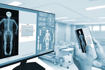 Why Are Bone Density Scans Important To Evaluate And Monitor Bone Health?