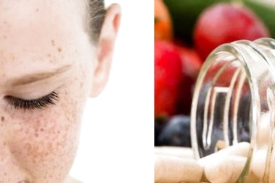Three Vitamins You Must Ensure in Your Body to Cure And Prevent Freckles on Skin