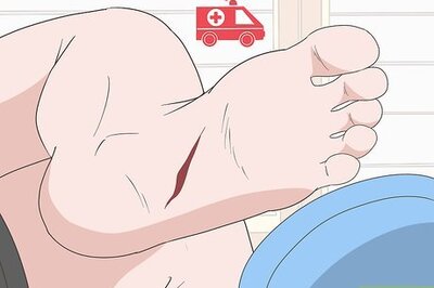 How to Treat a Cut on the Bottom of Your Foot