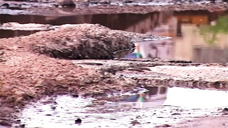 Pothole to Police Station: Hyderabad Man Files FIR Against Municipal Body After Injury Due to Bad Roads