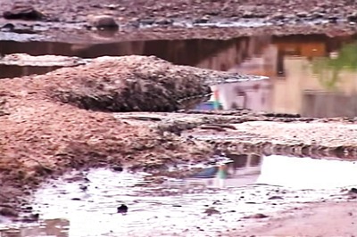 Pothole to Police Station: Hyderabad Man Files FIR Against Municipal Body After Injury Due to Bad Roads