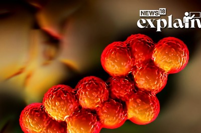 How AI Helped Find a New Antibiotic to Fight a Deadly Superbug | Explained