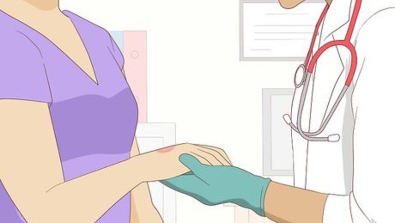 How to Stop Granuloma Annulare: Can Natural Remedies Help?