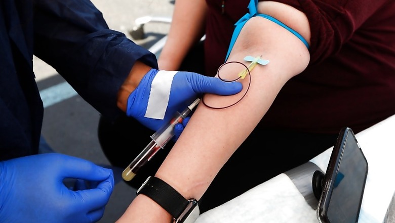 Coronavirus Antibodies Fade Fast But Not Necessarily Protection