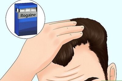 How to Fix a Receding Hairline