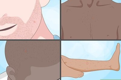 How to Spot Ingrown Hairs