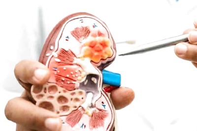 Going For A Kidney Transplant? Know What All To Take Care Of (Pre and Post The Surgery)