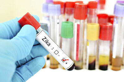 Zika Virus: Did You Know This Mosquito-borne Disease Can be Sexually Transmitted?