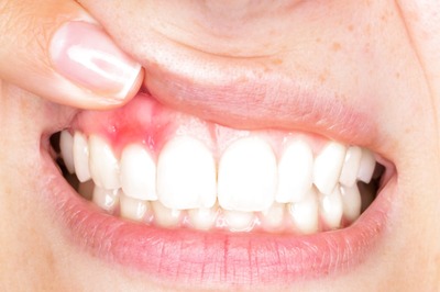 World Oral Health Day 2022: Why Oral Health And Hygiene Should Never Be Overlooked