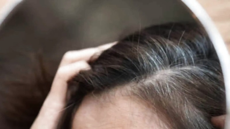 Want To Get Rid Of Grey Hair? Try These 3 Natural Ingredients From Your Kitchen