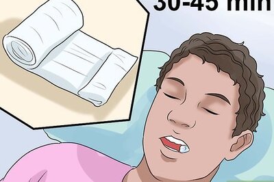 How to Clean Your Teeth After Wisdom Teeth Removal