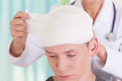 Head Injury; Everything You Need To Know