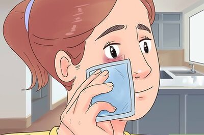 How to Get Rid of a Black Eye