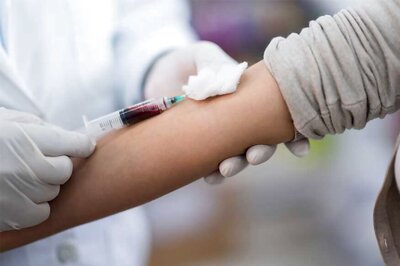 Kebab Skewer Splits US Teen's Skull But Misses Brain, Medics Call It 'One In a Million Accident'