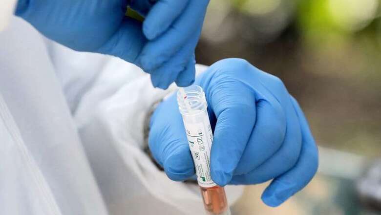 8 nurses Working at Private Hospital in Delhi Test Positive for Covid-19