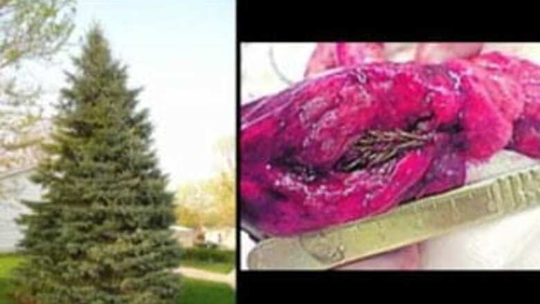 Sapling found growing in a man's 'cancerous' lung
