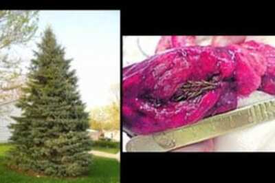 Sapling found growing in a man's 'cancerous' lung