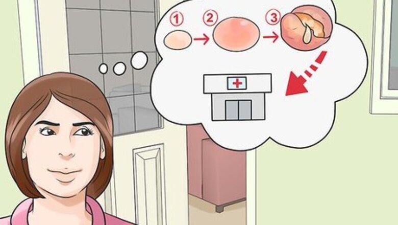 How to Get Rid of a Cyst