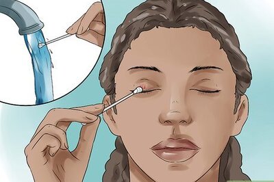 How to Get Rid Of a Stye