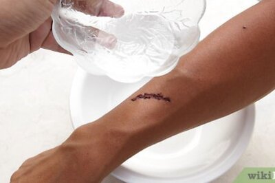 How to Apply a Butterfly Bandage