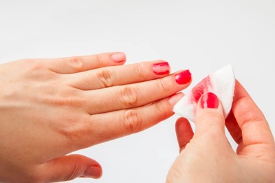 Girl, 14, Suffers Third-Degree Burns After Using Nail Polish Remover Near A Candle