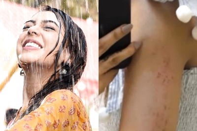 Bade Achhe Lagte Hain 2: Niti Taylor Gets Injured On Sets, Shares Pic of Her Bruised Arm