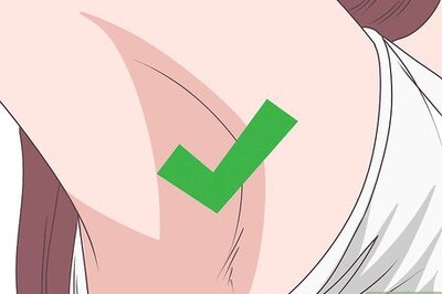 How to Treat Intertrigo