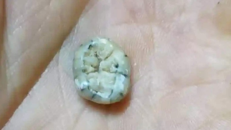 Child's 1,30,000-year-old Tooth Could Uncover the Untold Story of Extinct Ancestors