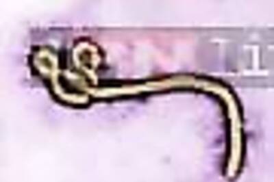 Guinea offers USD 10,000 to families killed by Ebola