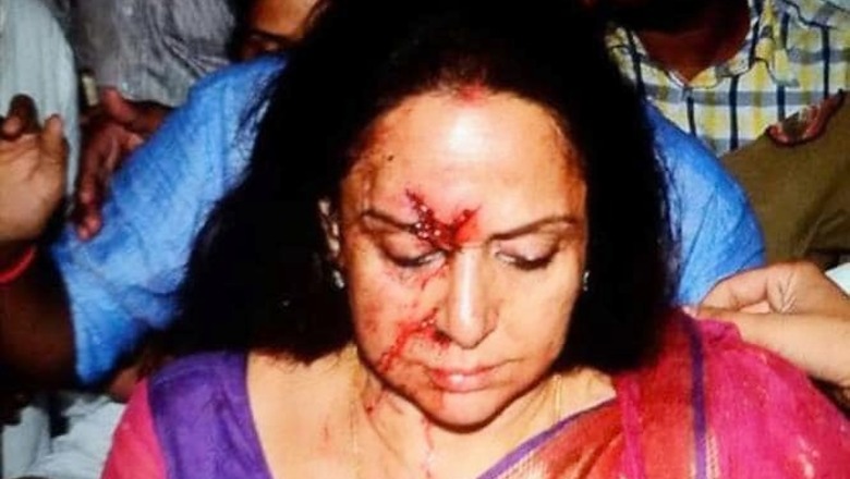 Hema Malini deeply pained by the death of the child killed in the accident involving her car