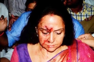Hema Malini deeply pained by the death of the child killed in the accident involving her car