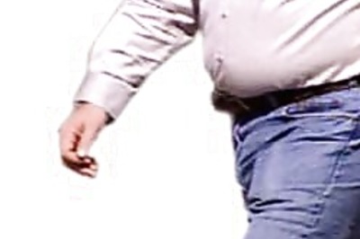 Obese men more prone to prostrate cancer