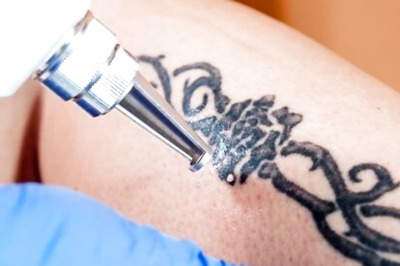 Are Tattoos Connected To A High Risk Of Lymphoma?