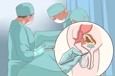 How to Treat Testicular Cancer