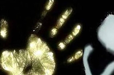 Teenager set ablaze by molester, dies