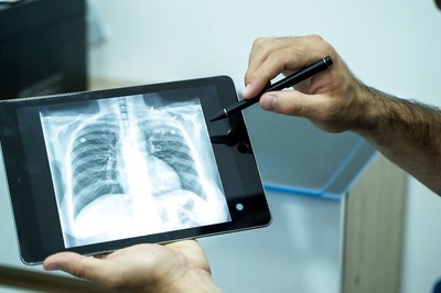 World TB Day 2023: What Is Tuberculosis And What Are Its Early Signs, Symptoms