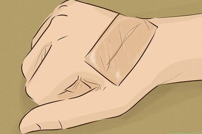 How to Heal Scars Fast