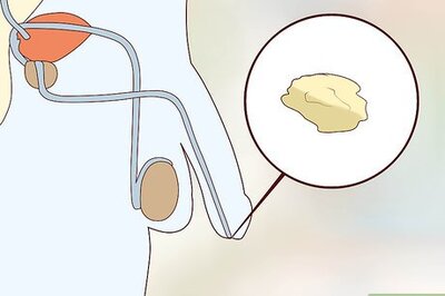 How to Recognize Trichomoniasis Symptoms (Men)