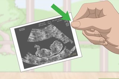 How to Store Ultrasound Photos