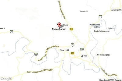 Conjoined twins born in Malappuram