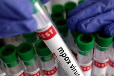 Local Clinic To Dermatology OPD: How Mpox Was Confirmed In Kerala’s 38-Year-Old Patient