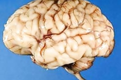 Brain has more memories than thought