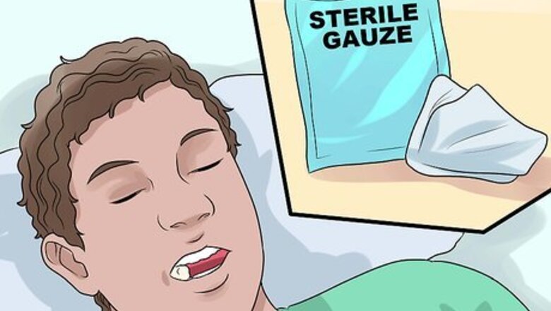 How to Heal Gums After a Tooth Extraction