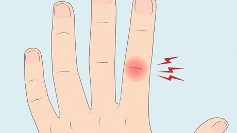 Symptoms of a Broken Knuckle & What To Do About It