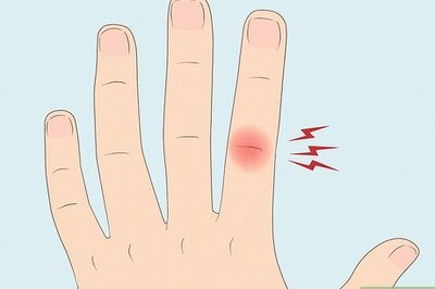 Symptoms of a Broken Knuckle & What To Do About It