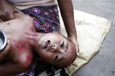 Two more Malaria deaths; toll reaches 52 in Tripura