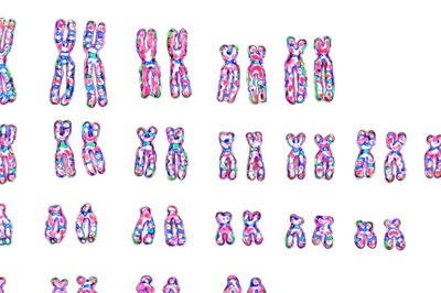 How Losing the Y Chromosome Could Shape Future Men's Health and Longevity